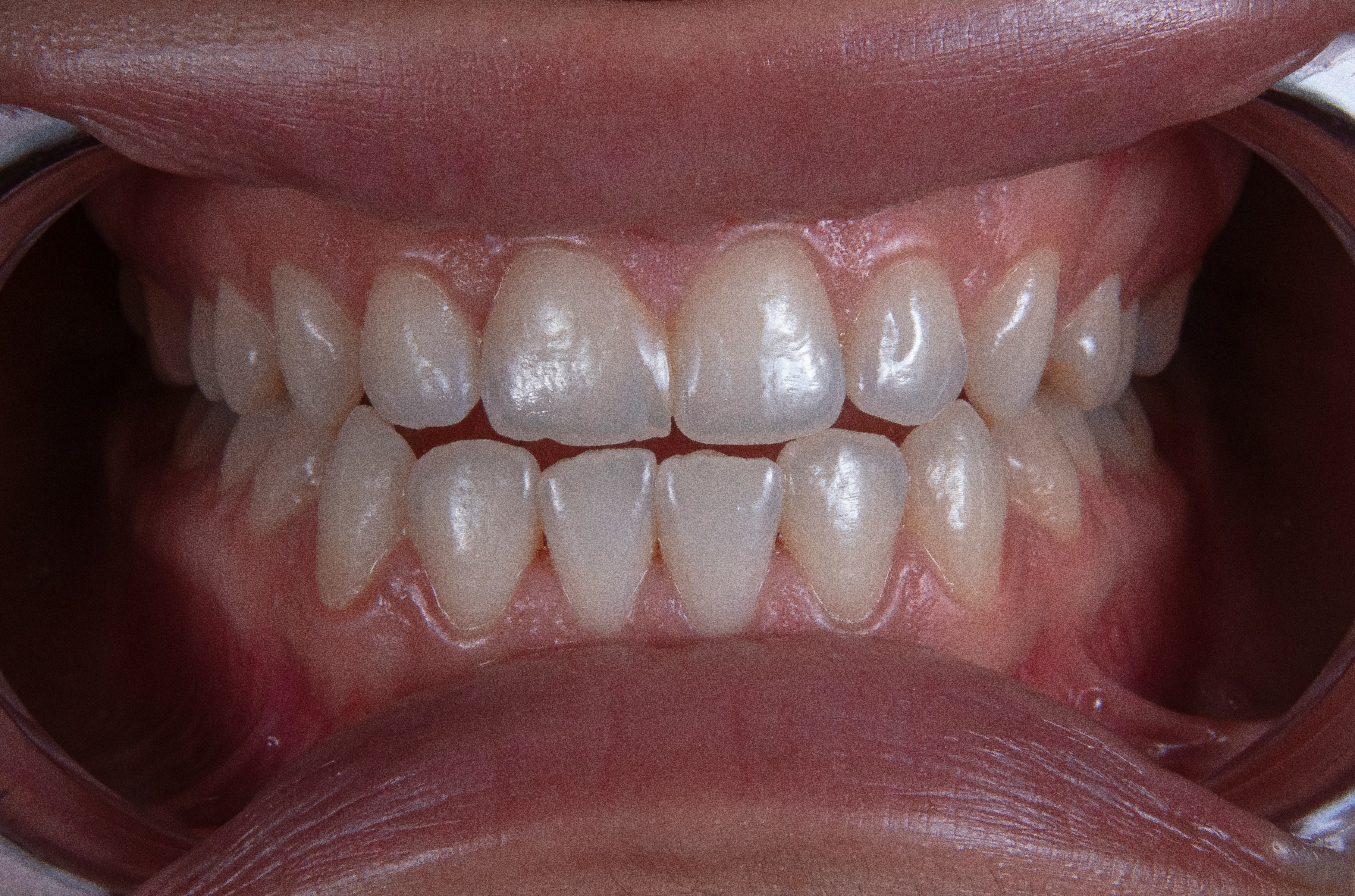 Smiling patient